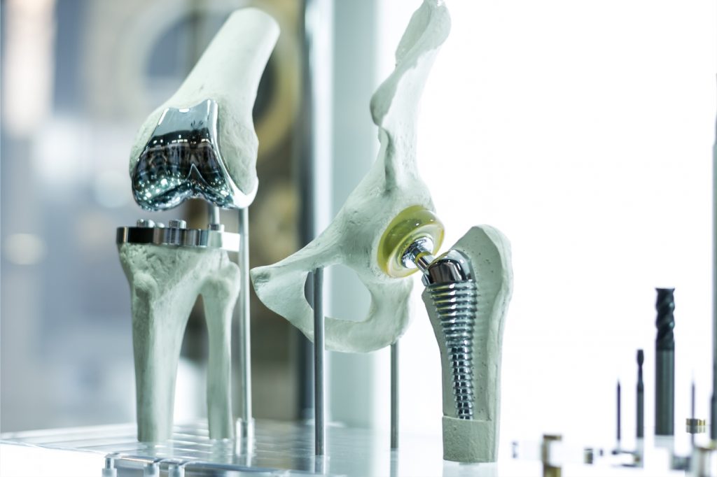 medical joint implants